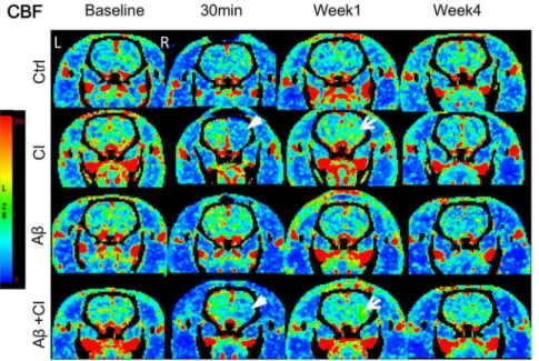 Figure 1. Cerebral blood flow maps at four time points in: control rat (1 st row); CI rat (2 nd row); Ab alone rat (3 rd row) and Ab+CI rat (4 th row)