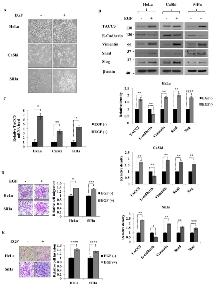 Figure 2. EGF stimulation induces the expression of TACC3. (A) Cervical cancer cells treated with EGF showed a morphological change associated with EMT