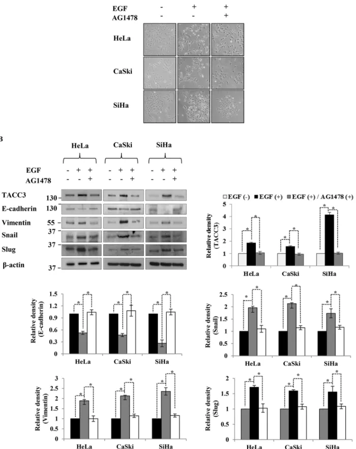 Figure 4. EGF-mediated TACC3 induction is dependent on EGFR activation. The inhibition of tyrosine kinase activity of EGFR abolished a morphological change associated with EMT (A) and EGF-mediated TACC3 induction (B)