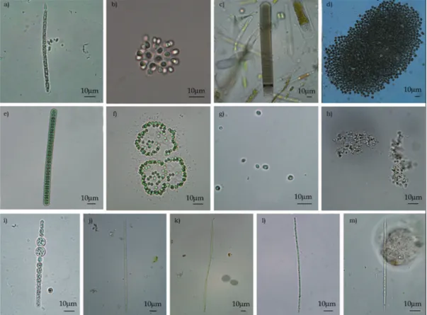 Fig 1. Photographs of potentially toxic Cyanobacteria taxa in the Zasavica River during the study period: (a) Cylindrospermopsis raciborskii; 
