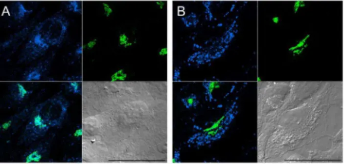 Figure 5. Visualization of live-cell surface sterols with TNM- TNM-AMCA. HeLa cells were treated with TNM-AMCA (1 mM) on ice for 30 min