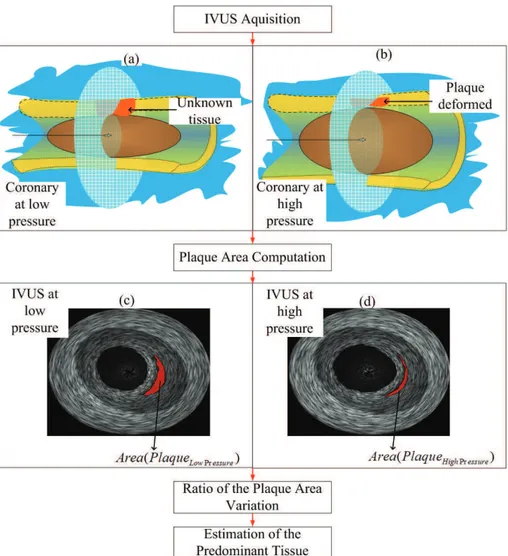 Figure 1. Block diagram of the proposed procedure. An illustration of an IVUS acquisition with a compliant balloon in: (a) low pressure; (b) high pressure