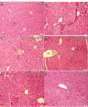 Figure  2.  Effect  of  R.  canina  fruit  extract  on  CCl 4