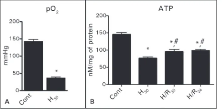 Figure 1. Levels of pO 2  before (n = 6) and after 30 minutes of hypoxia  (n = 9). Levels of intracellular ATP in groups Control (n = 9); H 30  (n = 9); 