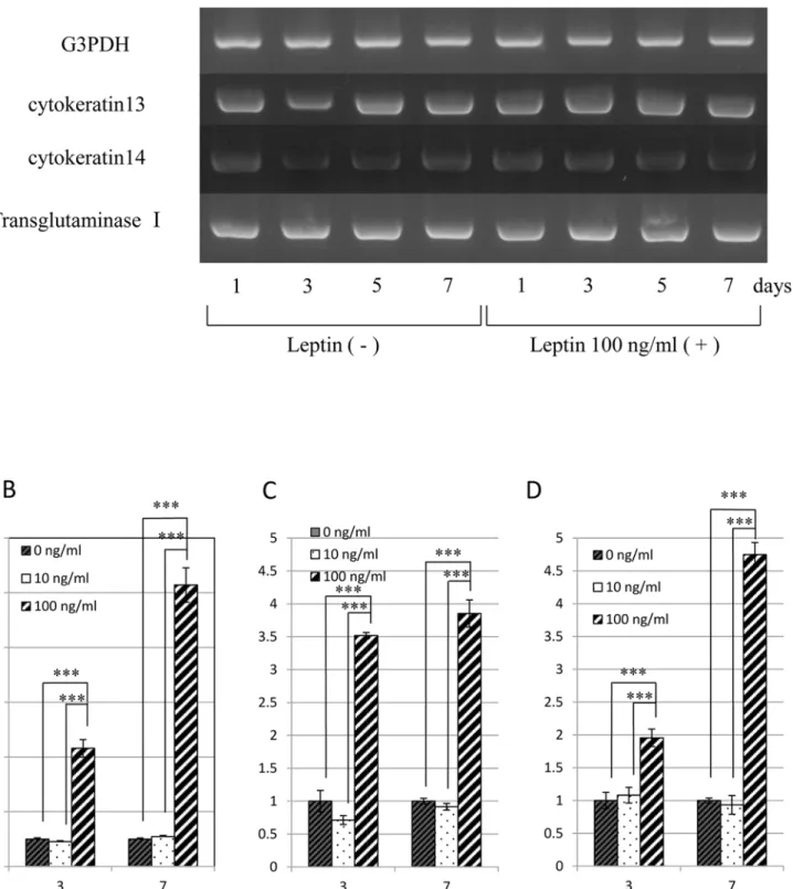 Fig 5. Effect of leptin on the expression of mRNA encoding G3PDH and Cytokeratin 13, Cytokeratin 14 and Transglutaminase I in human epidermal keratinocytes