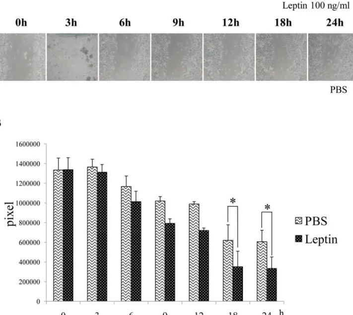 Fig 6. Effect of leptin on the migration of human epidermal keratinocytes. Leptin enhanced the migration of cells