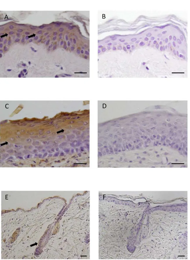 Fig 1. Immunohistochemical localization of Ob-R in human and mouse skin. (A) Immunohistochemical staining for Ob-R