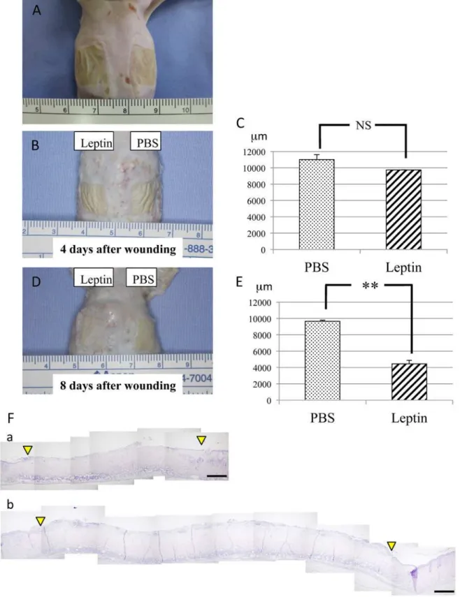 Fig 2. Effect of leptin on wound healing in mouse skin. (A) Chemical wounds created in mouse back skin by applying two pieces of filter paper (12x12mm each) soaked with 20% sodium hypochlorite for 5 minutes