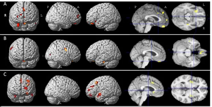 Table 4. Detailed results of the comparative analysis of white matter volume.