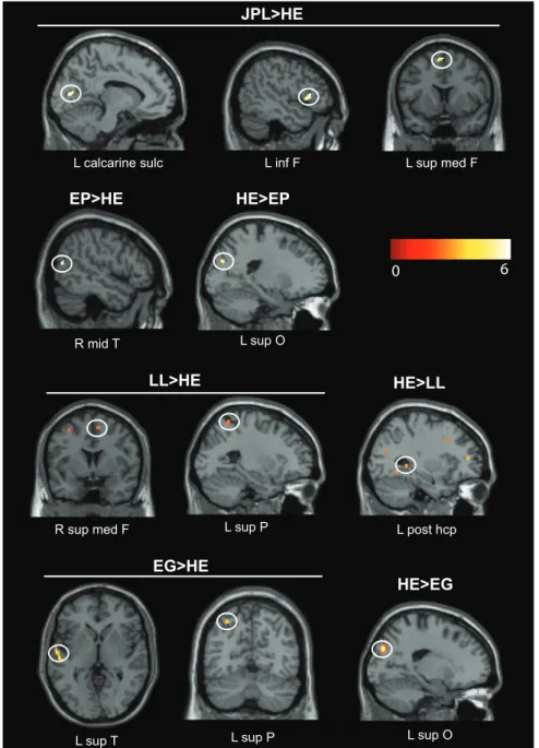 Figure 4 depicts summary representations of patients’ ability to engage in episodic future thinking (disturbed or spared) depicting sites of atrophy with associated hypothesized function and brain activations for each patient compared to healthy elders