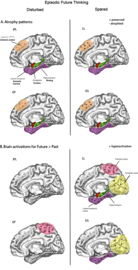 Figure 4. Summary representations of patients’ ability to engage in episodic future thinking (left: disturbed; right: spared) depicting (A) localization of preserved ( + ) or atrophied (2) brain regions and associated hypothesized function (superior medial