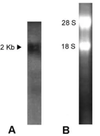 Figure 8. Northern blotting. (A) The blot was hybridized with Dig- Dig-labeled BjATl RNA probe