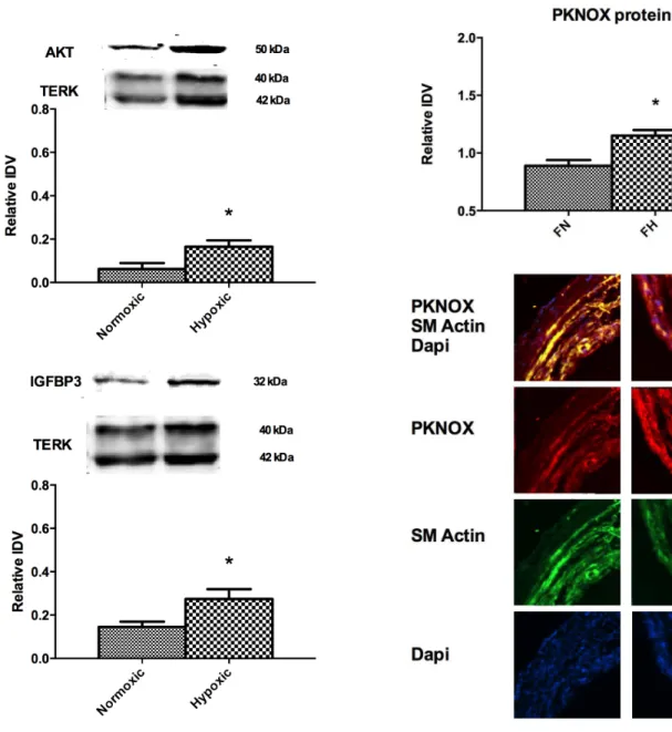 Figure 2. Demonstrates protein expression of (A) AKT and (B) IGFBP3. N = 4 in each group; Total extracellular regulated kinase (TERK) served as an internal control to which AKT and IGFBP3 were normalized to provide relative integrated density (IDV)