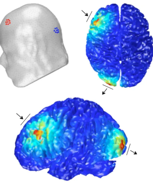 Fig 2. Modeled stimulation electric field. Electrode placement locations (anode in red and cathode in blue) and the output of finite element modeling of the estimated electric field for the Anodal stimulation condition.