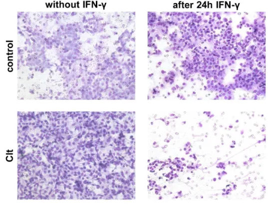 Fig 5. Boyden chamber results. A: Representative images of stained cells attached to the lower surface of polycarbonate membranes after migration of IEC-18 towards medium containing Clt or not and after or without IFN-γ pretreatment