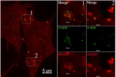 Figure 5. Structured Illumination (SIM) imaging of a-synuclein mediated vesicle rupture