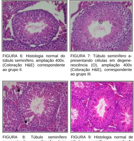 FIGURA  7:  Túbulo  seminífero  a- a-presentando  células  em   degene-rescência  (O),  ampliação  400x  (Coloração  H&amp;E),  correspondente  ao grupo III.