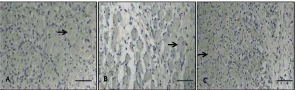 Figure 4 - Immunohistochemistry for COX-2 after 6 days post-injury: (a) control group; (b) laser at  10 J/cm 2  (c) laser at 50 J/cm 2 