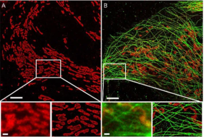 Fig. 2. STORM microscopy in microfluidic chambers. Samples were prepared using a setup for automated immunostaining