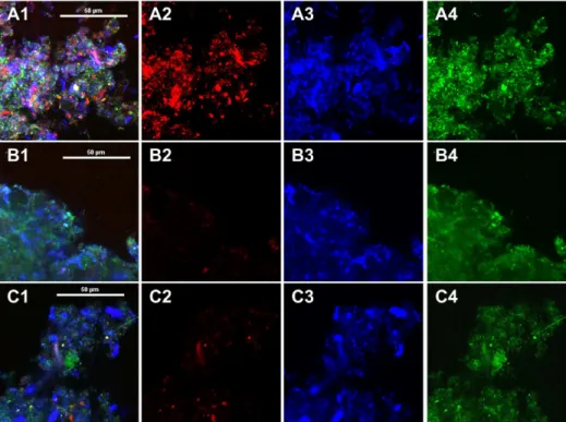 Fig 5. CLSM images of AS1 (A1-A4), AS2 (B1-B4) and AS3 (C1-C4). Symbols 1–4: 1 exhibits combination of individual images in 2–4, 2 represents CLSM image of α-polysaccharides (Con A), 3 represents CLSM image of β-polysaccharides (Calcofluor white), and 4 re