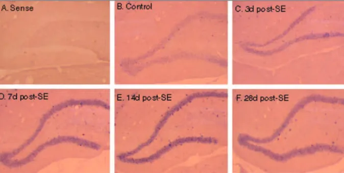 Fig 2. Expression MEF2C mRNA in dentate gyrus during development. (A) In situ hybridization of P14 tissue with MEF2C sense  riboprobe shows the representative lack of signal and minimal background staining