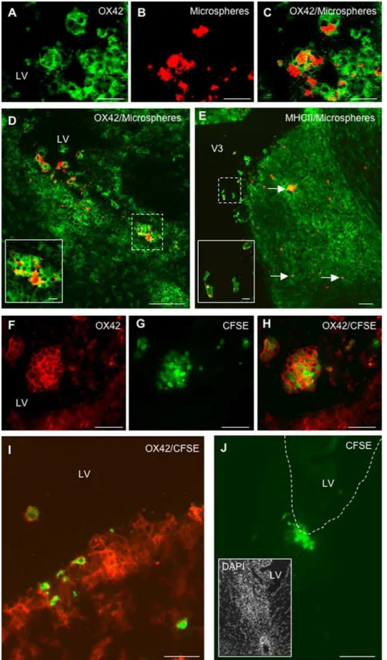 Figure 1. CSF-circulating DCs infiltrate the periventricular parenchyma. Fluorescent microspheres or DCs labeled with the cytoplasmic fluorescent marker CFSE were injected into the left lateral ventricle of EAE rats (n = 32) at the clinical peak of disease