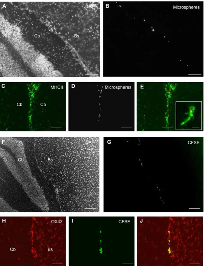 Figure 4. CSF-circulating DCs migrate along the deep penetrating meninges. Fluorescent microspheres or DCs labeled with the cytoplasmic fluorescent marker CFSE were injected into the left lateral ventricle of EAE rats (n = 32) at the clinical peak of disea