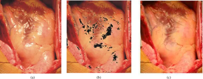 Fig. 9. Detection and correction of specular reflection (a) Original image (b) Detection of specularities (black) (c) Correction  image by  Г  method 