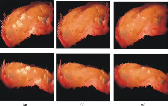 Fig. 11.  Different views of the 3D heart surface reconstruction (a) Original heart images with specular reflection (b) Proposed  method (c) Inpainting algorithm ( Arnold et al., 2010 ) 
