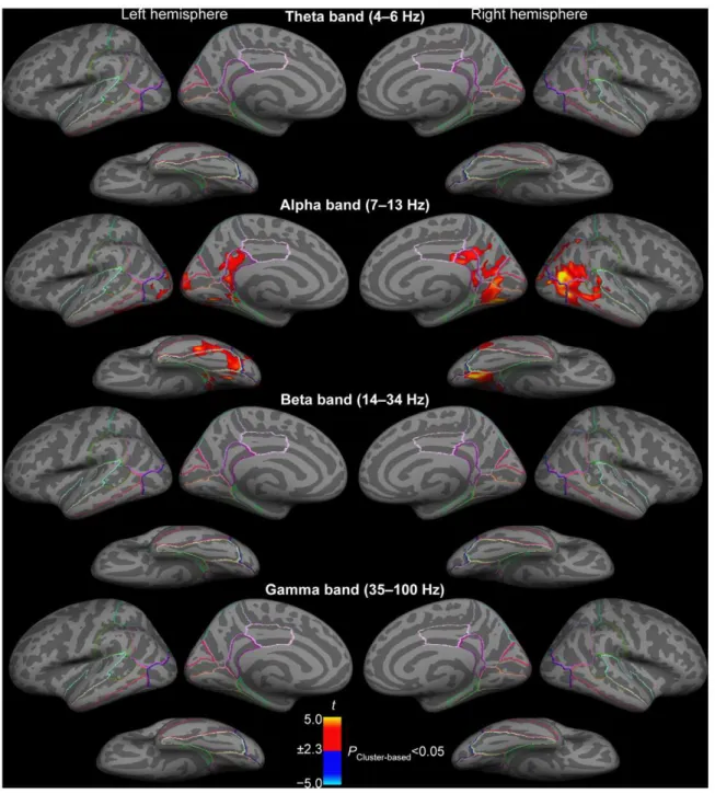 Figure 3. Comparisons of power changes of sustained oscillatory activity between auditory attention to phonetic vs