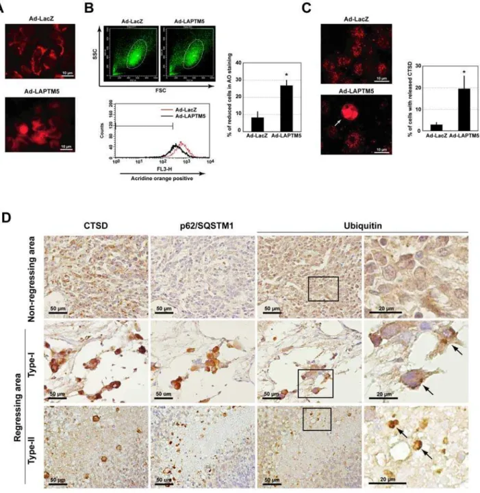 Figure 7. Induction of lysosomal-membrane permeabilization (LMP) during LAPTM5-induced cell death
