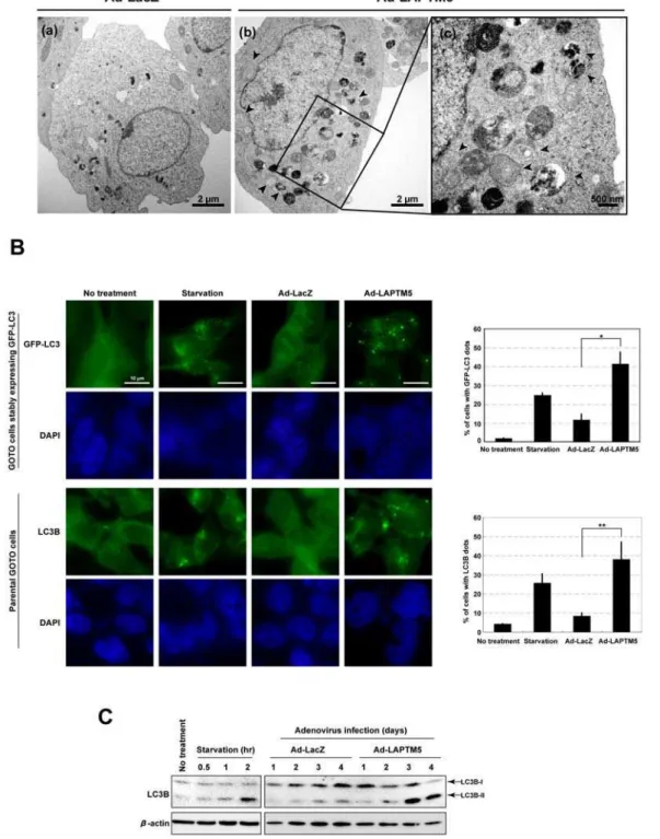 Figure 4. Appearance of autophagic vacuoles during LAPTM5-induced cell death. (A) Representative transmission-electron micrographs of Ad-LacZ (a) or Ad-LAPTM5 (b and c) -infected GOTO cells 4 days after infection
