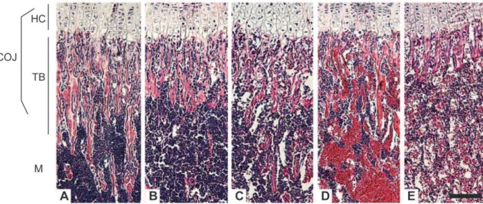 Figure 1. Collagen X Tg and KO mice have an altered chondro-osseous junction. Hematoxylin and eosin staining of longitudinal sections of tibia from (A) week-3 C57Bl/6 wild type (WT), (B) C57Bl/6 congenic collagen X transgenic (Tg), (C) null (KO), and perin