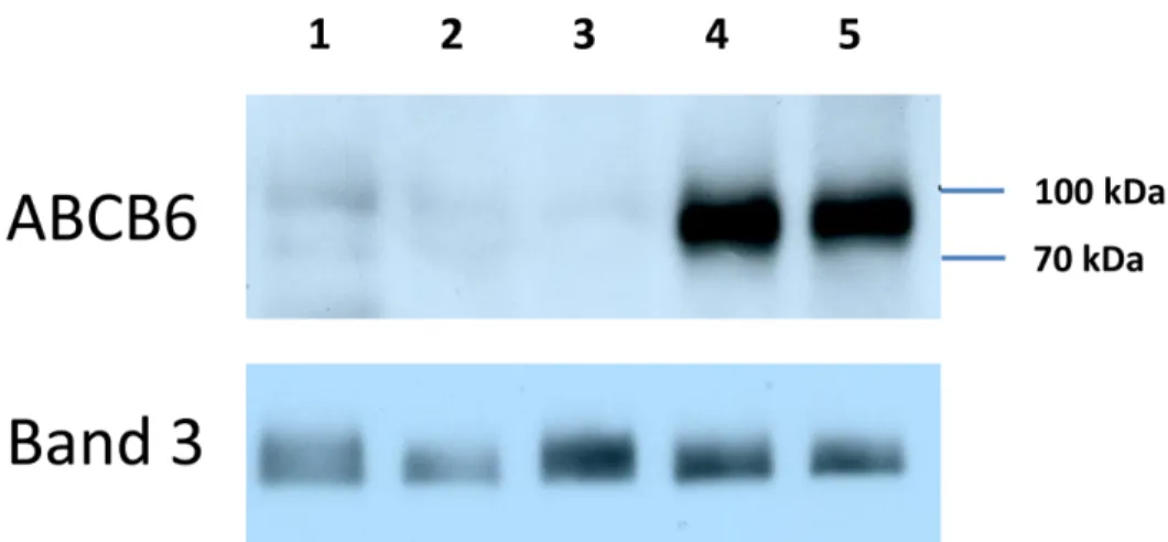 Figure 3. Characterization of ABCB6 mutations responsible for the Lan- blood type. RBC membrane lysates (80 ug/lane) were prepared from a compound heterozygote individual carrying the R276W and the G588S mutations (lane 1); homozygotes carrying the R192W m