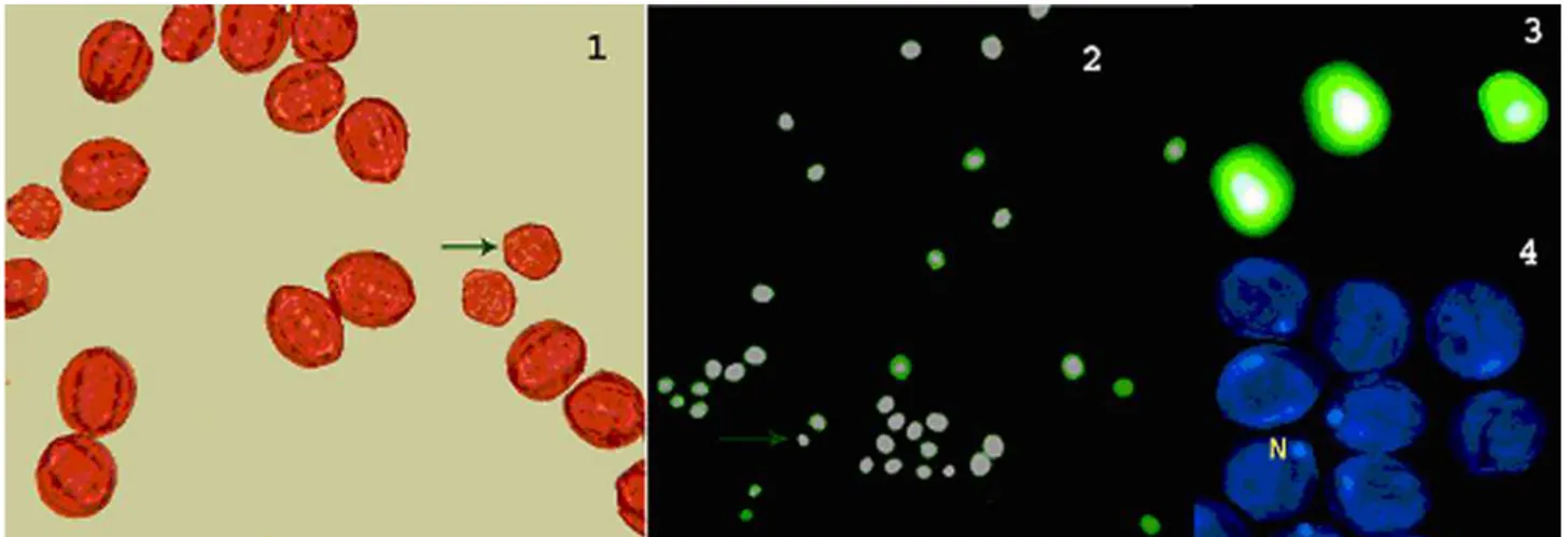 Fig. 1-4 .  Microspores of Aesculus lava stained with aceto-orcein (smaller microspore – arrow; x40) and luorescein-diacetate (Fig