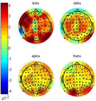 Figure 3 presents topologies of power differences that were calculated by subtracting power in non-initiation state from initiation state in each frequency band