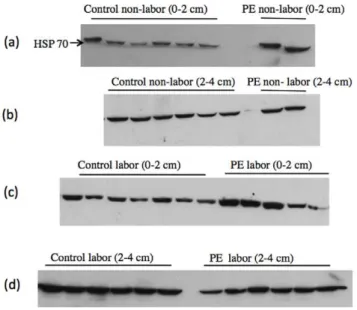 Figure 8. Shows HSP 70 expression in three different placenta zones for all patients in the labor group (n = 6 patients) (upper panel)