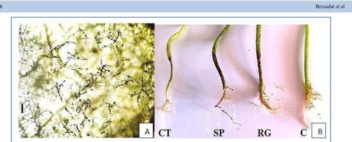 Figure 3 A. conidia chain and mycelium produced on the upper side of tomato infected leaf with A