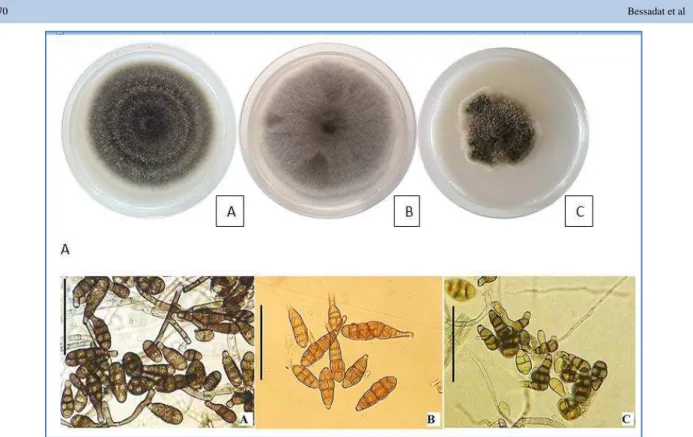 Figure 1 Morphology of small- spore Alternaria species causing blight disease on member of Solanaceae in Algeria on PSA culture