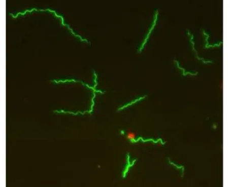 FIGURA 1 - Espiroqueta Borrelia burgdorferi, causadora da doença de Lyme, corada com Syto 9 e visualizada por microscopia fluorescente.