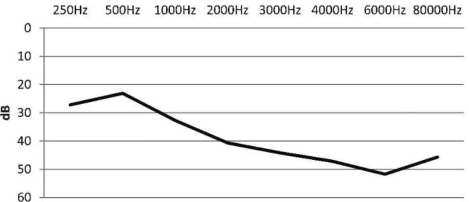 Table 2 depicts the B coefficients, calculated to demon- demon-strate the importance of each audiogram frequency in the SRT.