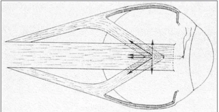 Figure 1 - Schematic drawing of Carlson &amp; Jampolsky hemitransposition  technique (4)