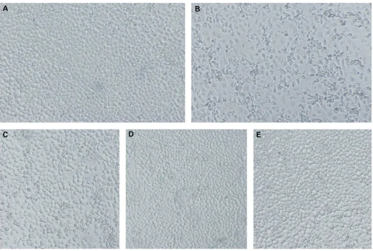 Figure 5.  Photos of matrine against H9N2 in vitro when cytopathic of viral control was +++