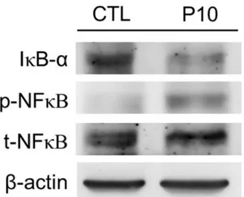 Fig 7. The NF-κB pathway of lung tissue in animals subjected to VILI. Densitometry analysis of the IκB-α, p-NF-κB, and t-NF-κB levels expressed in western blot assay performed using rabbit anti-IκB-α, p-NF-κB, and t-NF-κB polyclonal antibodies, respectivel