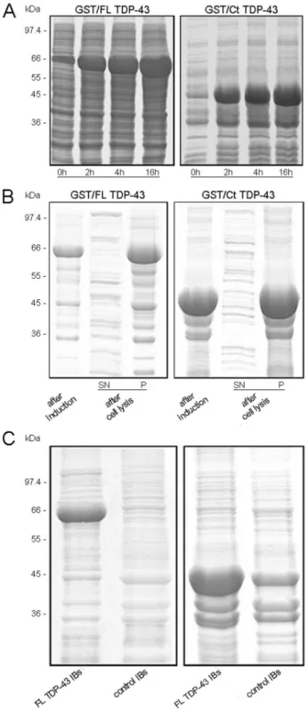 Figure 1. FL and Ct TDP-43 expression in E. coli cells. (A) SDS- SDS-PAGE analysis of bacterial proteins at different GST/FL TDP-43 (left) and GST/Ct TDP-43 (right) induction times (0 h, 2 h, 4 h and 16 h) with 1 mM IPTG at the temperature of 37 u C