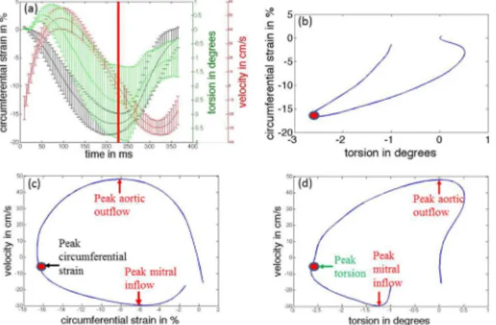 Fig 6. Temporal inter-relationships between LV mechanics and LV chamber hemodynamics. (a) Comparisons of temporal responses of circumferential strain, torsion and composite velocity (temporally scaled to a standard heart rate)