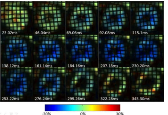 Fig 2. Circumferential strain evolution over a cardiac cycle in a representative NHP. Circumferential strain color maps with tag overlay in a mid-ventricular short-axis slice of a representative NHP over the entire cardiac cycle depicting systolic compress