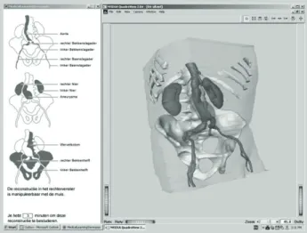 Figura 2  Captura de tela da fase de estudo. Foram estudados tanto a auto- auto-rotação da anatomia tereoptically 3D (com óculos) quanto a  biocularly (sem óculos)