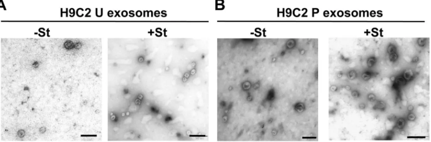 Fig 1. Glucose starvation increases exosome secretion in H9C2 cells. (A-B) Representative electron microscopy images of isolated U and P exosomes collected from 90 ml of conditioned medium from H9C2 cells grown for 48 h under glucose-starved (+St) or gluco