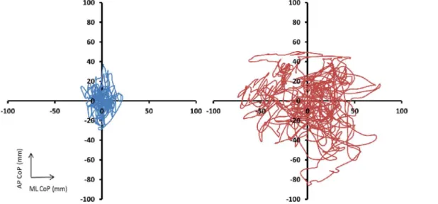Figure 1. Representative examples of bidimensional center of pressure (CoP) trajectory for a representative subject from the